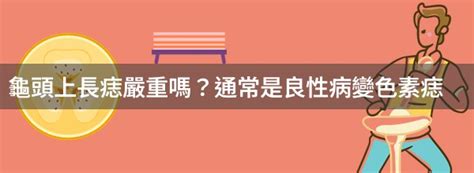 龜頭上有痣|男性健康常識：龜頭長痣是否正常？